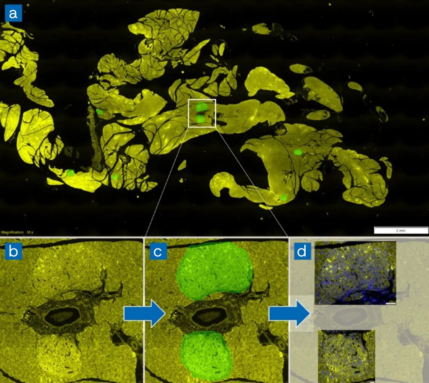 Digital Pathology